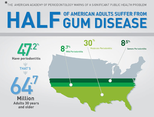 half gum